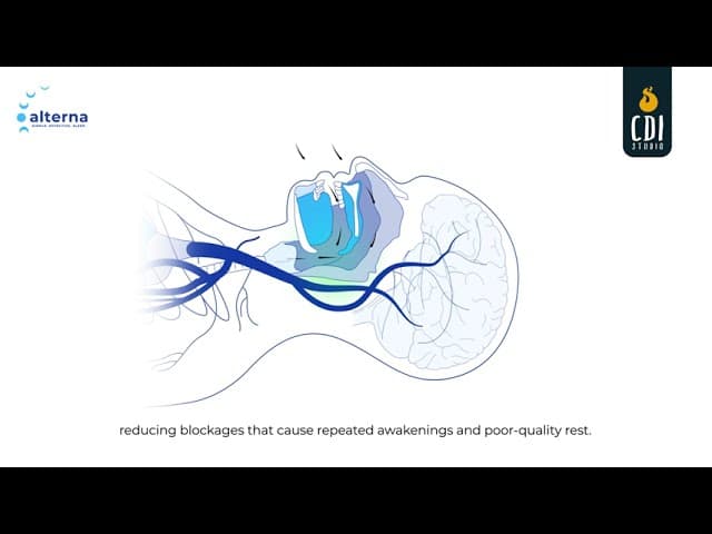 Sleep Apnea OAT Treatment