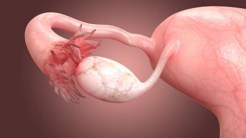  Female reproductive system showing the uterus, fallopian tube, and ovary