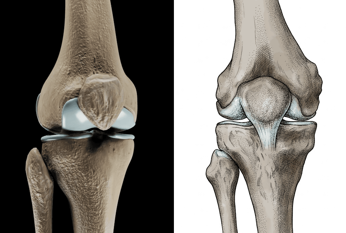 3D medical animation versus static medical illustration comparison