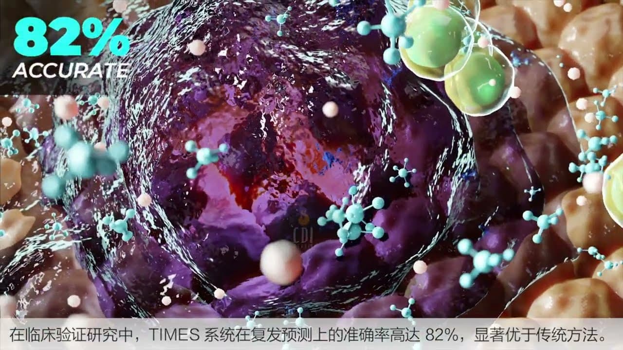 Liver Cancer Recurrence & Tumor Progression