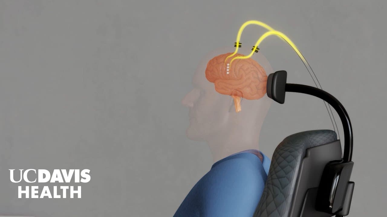 Medical Device Demo