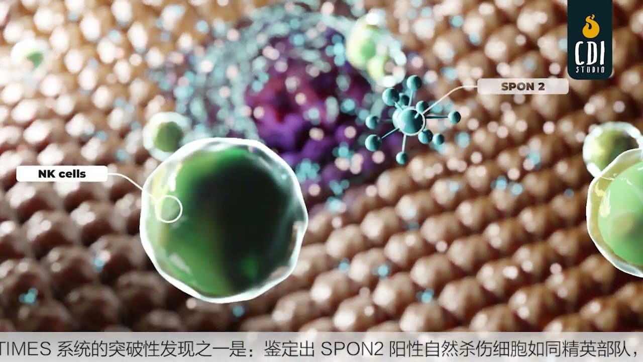 Liver Cancer Recurrence & Tumor Progression Explained | 3D Medical Animation